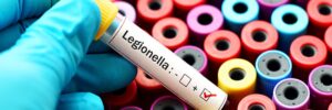 Controllo antilegionella